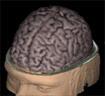 vbnautilus